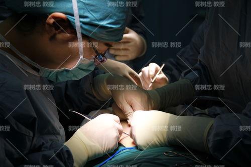 成人怎么取肚脐血视频,成人肚脐血采集操作步骤详解