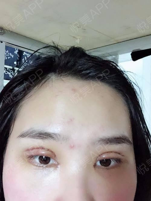 成人眼睛筛查视频教程,轻松掌握护眼秘诀